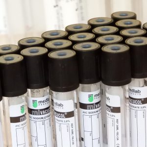tubes vacuum, lab, medical, health, diagnostics, tubes for esr, pierre was the head of the, patient, disease, to treat, therapy, care, chemistry, microscope, blood sampling, medical equipment, test, science, the doctor, analysis, microbiology, technique, lab technician